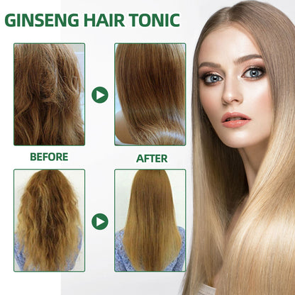 OUHOE Ginseng Hair Growth Lotion