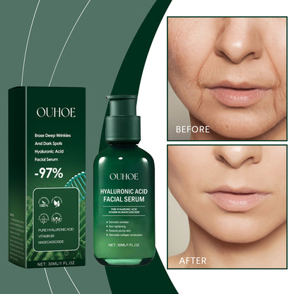OUHOE Hyaluronic Acid Facial Serum